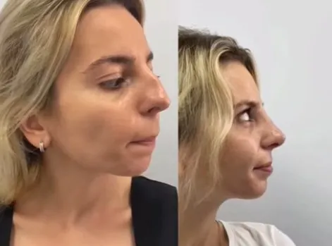 video5