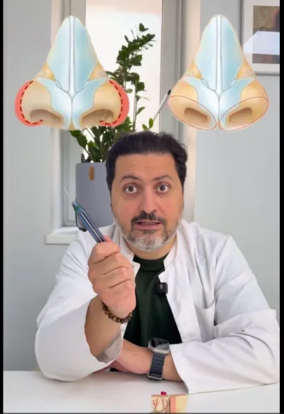 video10