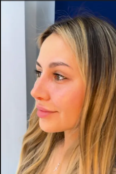 video9