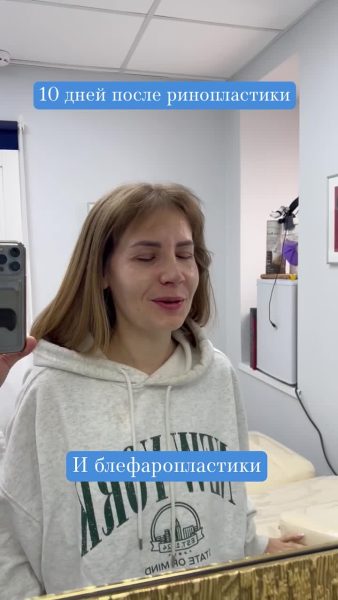 video44