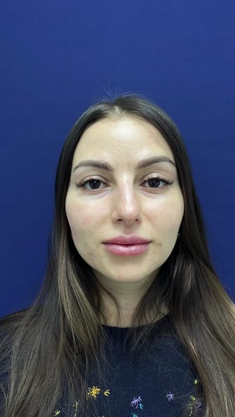 video42